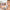 Zephoco 8-Color Concealer Palette Full Coverage for Dark Circles Blemishes Acne Matte Lasting Brightening Skin Foundation Makeup